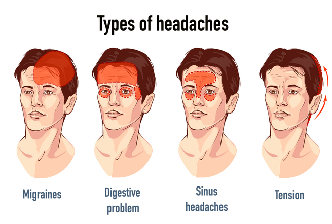 types of Headaches